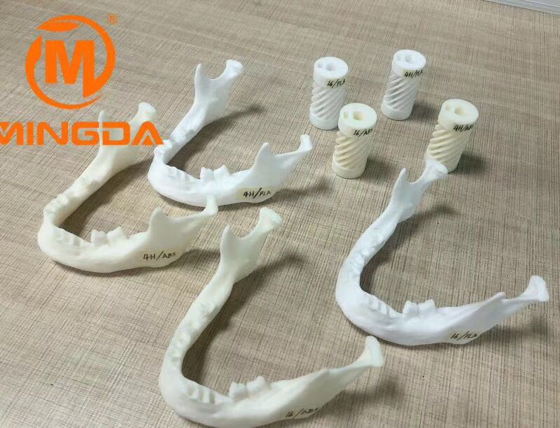 工業級3D打印機在牙科行業的應用(圖1)